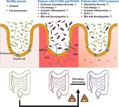 Treating From the Inside Out: Relevance of Fecal Microbiota Transplantation to Counteract Gut Damage in GVHD and HIV Infection